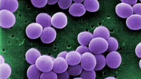 Septicemia y endocarditis: S. pneumoniae, S. pyogenes, S. viridans, Staphylococcus (productores y no productores de penicilinasa), E. coli, P. mirabilis y algunas especies de Klebsiella.

La cefalotina sódica puede ser administrada de manera profiláctica antes, durante y después de cirugías en las que exista una infección potencial.