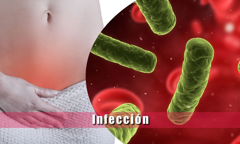 1. Infecciones gastrointestinales.

2. Infecciones genitourinarias e infecciones renales.

3. Septicemia.

4. Peritonitis o infecciones pélvicas.

5. Infecciones intraabdominales.

6. Infecciones de la piel, tejidos blandos y óseas.

7. Infecciones oculares.

8. Heridas y quemaduras infectadas.

9. Infecciones de huesos y articulaciones.

Por bacteria gram negativa como Pseudomona aeruginosa, E. coli, Proteus, Klebsiella, Enterobacter, Serratia, Citrobacter, Staphylococcus o Neisseria gonorrhoeae.