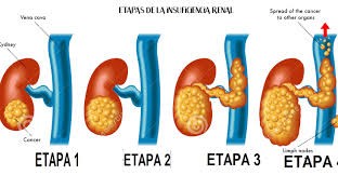 El uso prolongado de AINES en combinación con acetaminofén puede incrementar el riesgo de daño renal. 

Algunos AINES pueden reducir el efecto terapéutico de algunos antihipertensivos y diuréticos.

El uso simultánea con inhibidores de la enzima convertidora de angiotensina puede incrementar el riesgo de daño renal (con mayor riego en pacientes con hipovolemia).

El probenecid puede disminuir la eliminación del ketorolaco y por lo tanto incrementar las concentraciones plasmáticas del analgésico.

La toxicidad del metotrexato se puede incrementar con la administración conjunta de ketorolaco.

El uso combinado con hipoprotrombinemia como el ácido valproico, plicamicina, cefotetan y cefamandol incrementa el riesgo de hemorragia. 