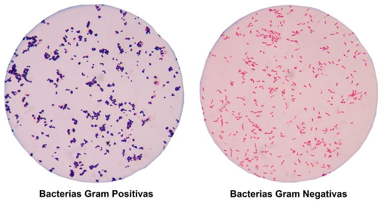 La actividad bactericida de Cefotaxima resulta de la inhibición de la síntesis de la pared celular.

Cefotaxima tiene una actividad in vitro en contra de una gran cantidad de cepas gram positivas y gram negativas (aerobias) y anaerobias.

De esta forma la cefotaxima se indica en:

– El tratamiento de pacientes con infecciones serias causadas por cepas susceptibles en el tracto respiratorio inferior.

– Infecciones en el tracto genitourinario.

– Infecciones ginecológicas.

– Infecciones de la piel y estructuras cutáneas.

– Bacteriemia y septicemia por gérmenes susceptibles.

– Infecciones intraabdominales, de hueso, articulaciones y del sistema nervioso central.